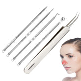 Pimple Popping Tool Blackhead Remover - TWEEZER WORLD