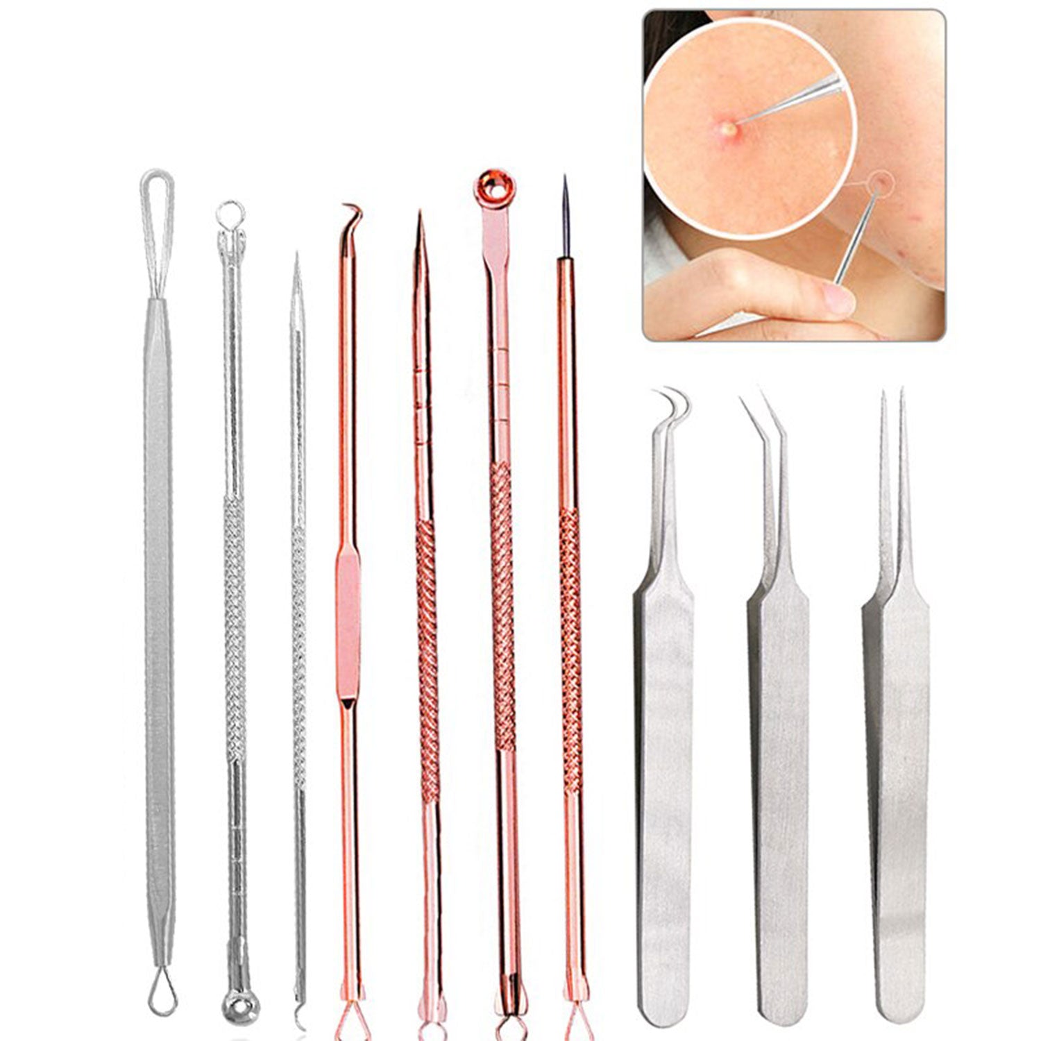 Blackhead Removal Tools, Pimple Remover - TWEEZER WORLD