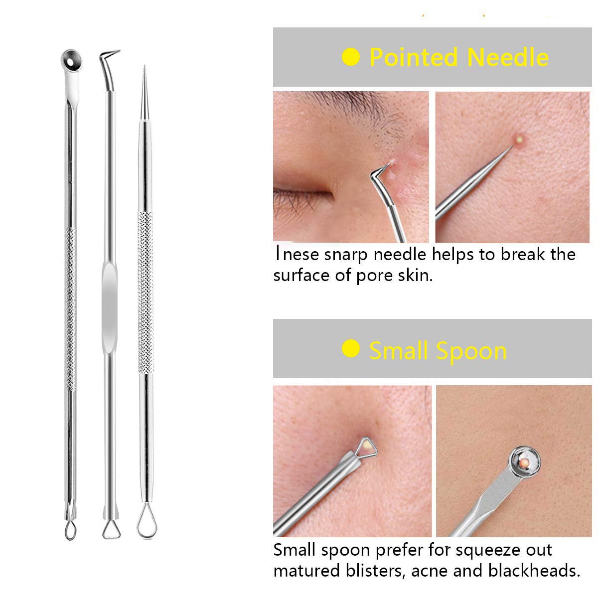 Blackhead Extractor Tool 3 Probe Set - TWEEZER WORLD