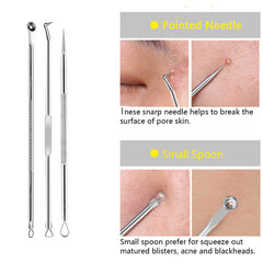 Blackhead Extractor Tool 3 Probe Set - TWEEZER WORLD
