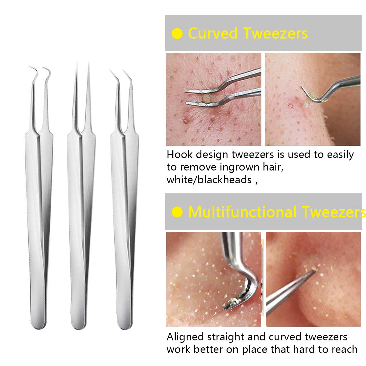 Blackhead Extractor Tool 3 Tweezers Set - TWEEZER WORLD