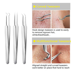 Blackhead Extractor Tool 3 Tweezers Set - TWEEZER WORLD