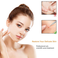Blackhead Extractor Tool, Blackheads Set, Skin - TWEEZER WORLD