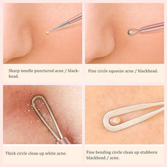 Blackhead Removal Tool, Blemish Probe - TWEEZER WORLD