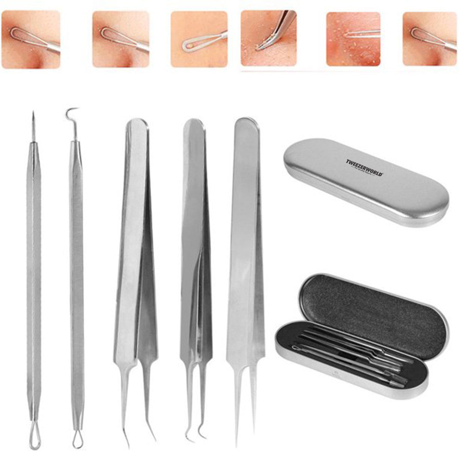 Blackhead Clearing Tool Blackheads Popper Silver Set 2- TWEEZER WORLD
