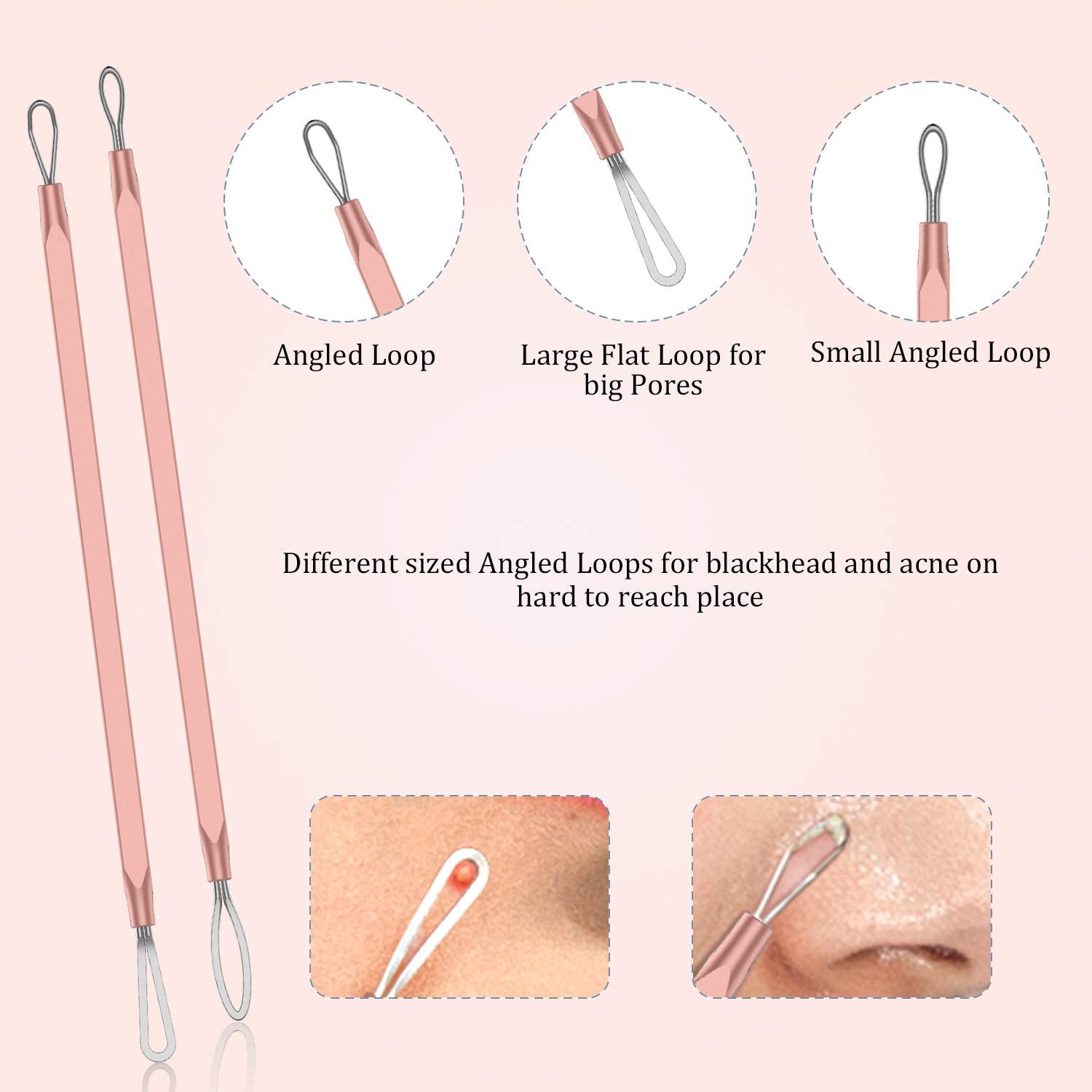 Blackhead Remover Pimple Popper Rose gold Tool Kit  Tool for Nose Face